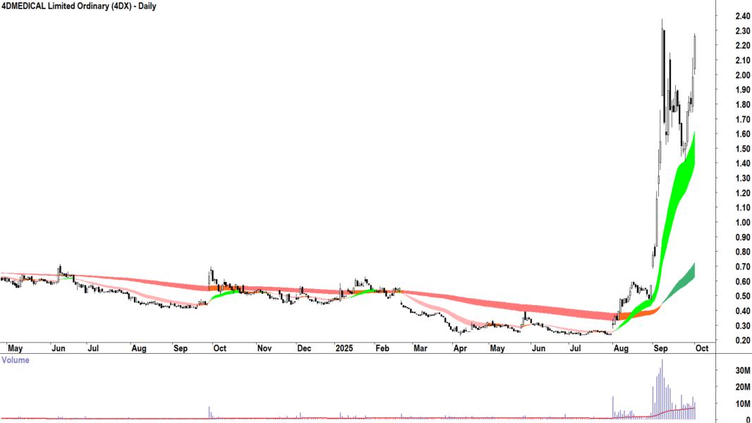 4DMEDICAL (ASX-4DX) daily chart 1 October 2025