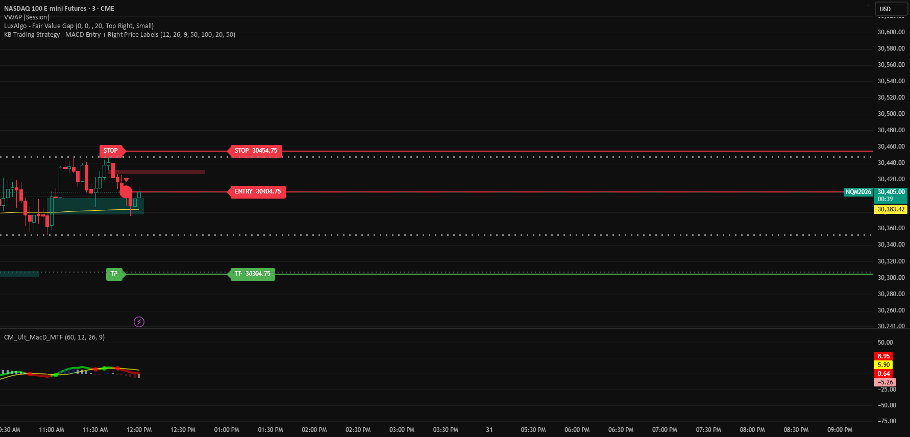 KB Trading Strategy - MACD Entry + Stop/TP Rays - المؤشر حسب kboyd_trd ...