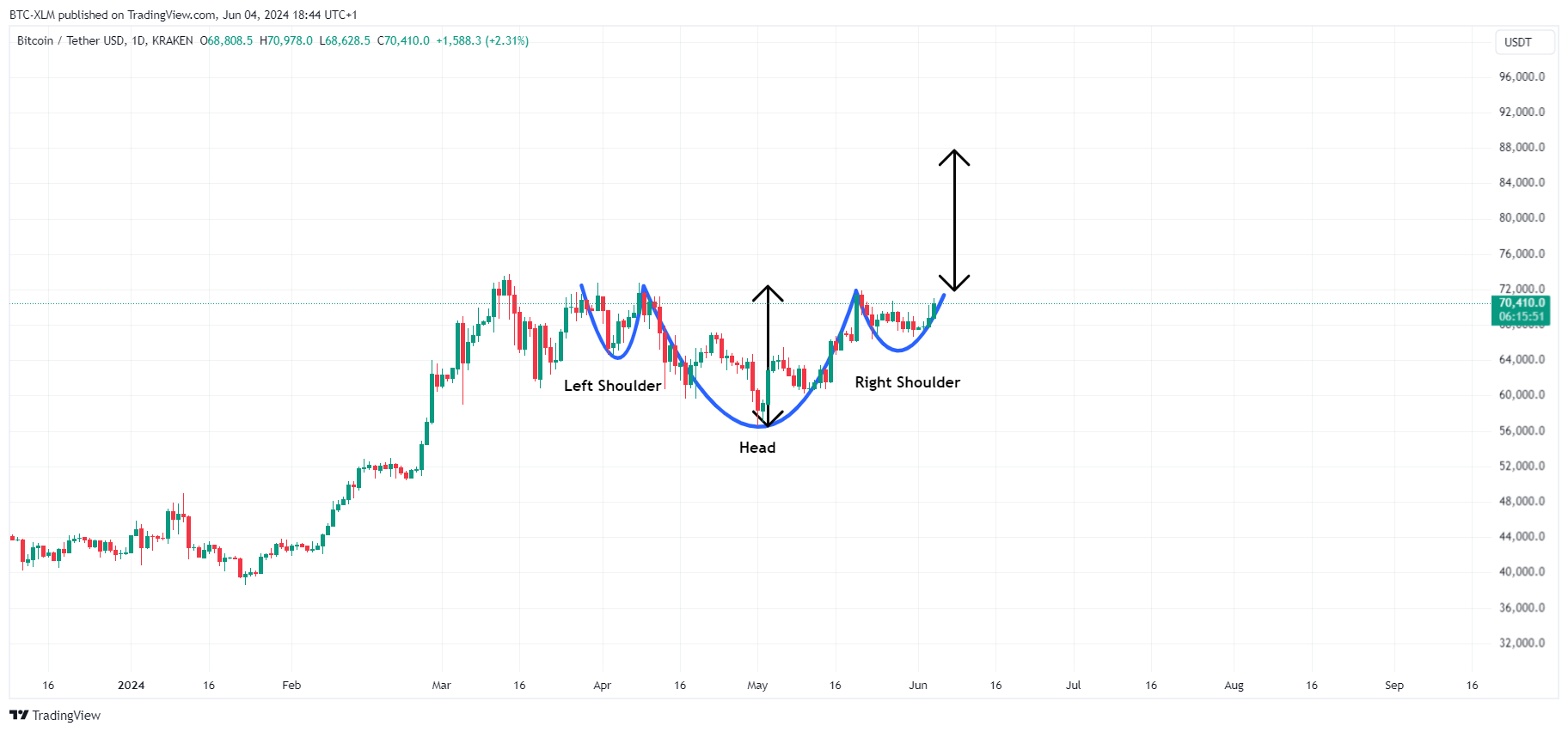 KRAKEN:BTCUSDT圖表圖片，作者：BTC-XLM