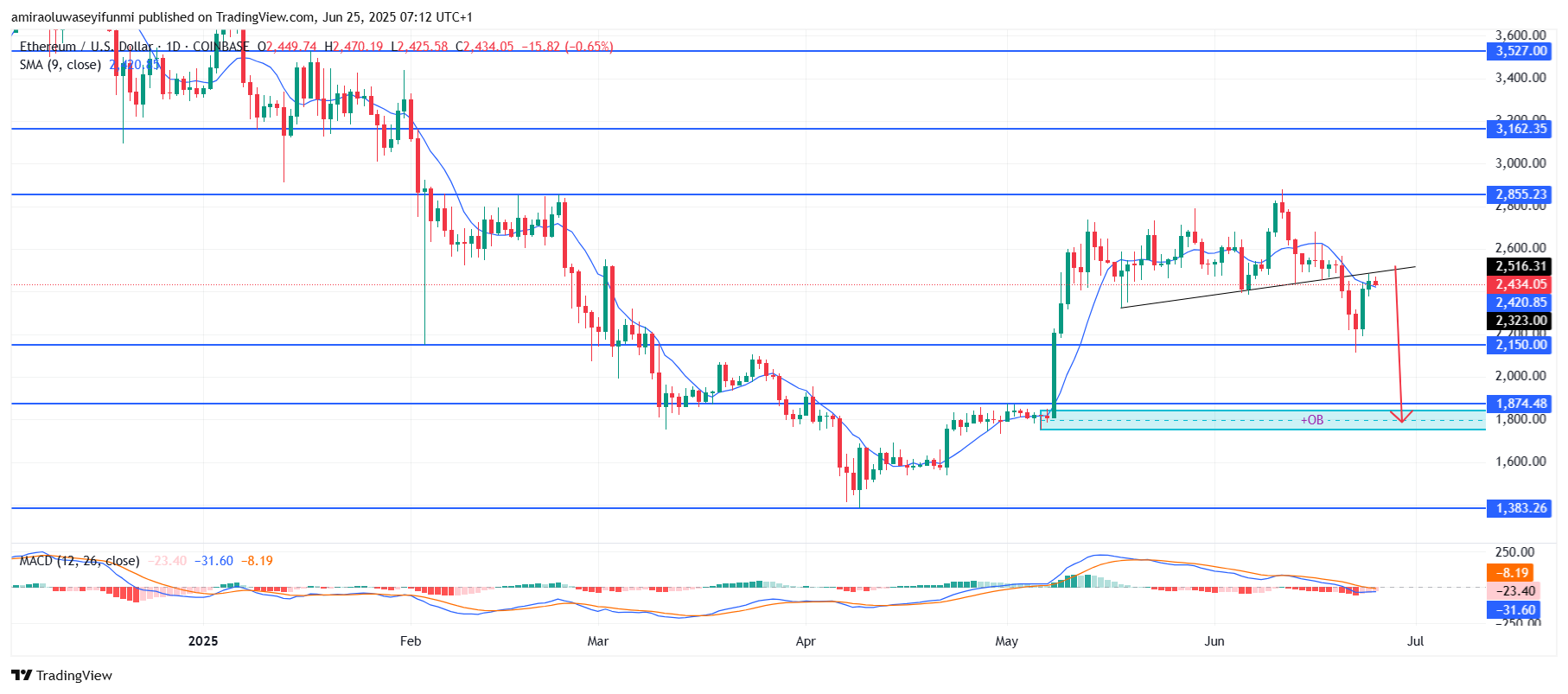 COINBASE:ETHUSD Chart Image by amiraoluwaseyifunmi