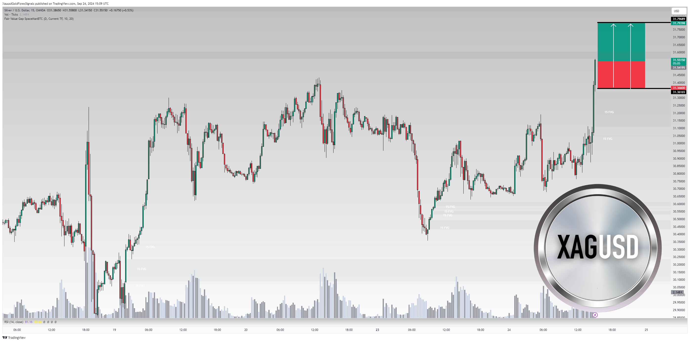 XauusdGoldForexSignals tarafından OANDA:XAGUSD Grafik Görseli