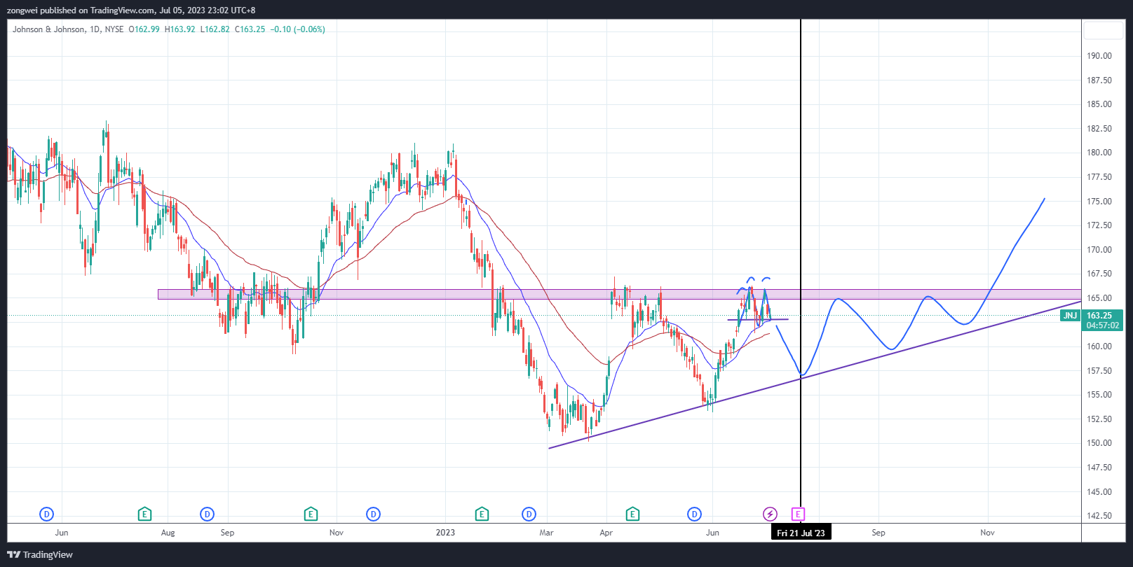 NYSE:JNJ Chart Image by zongwei