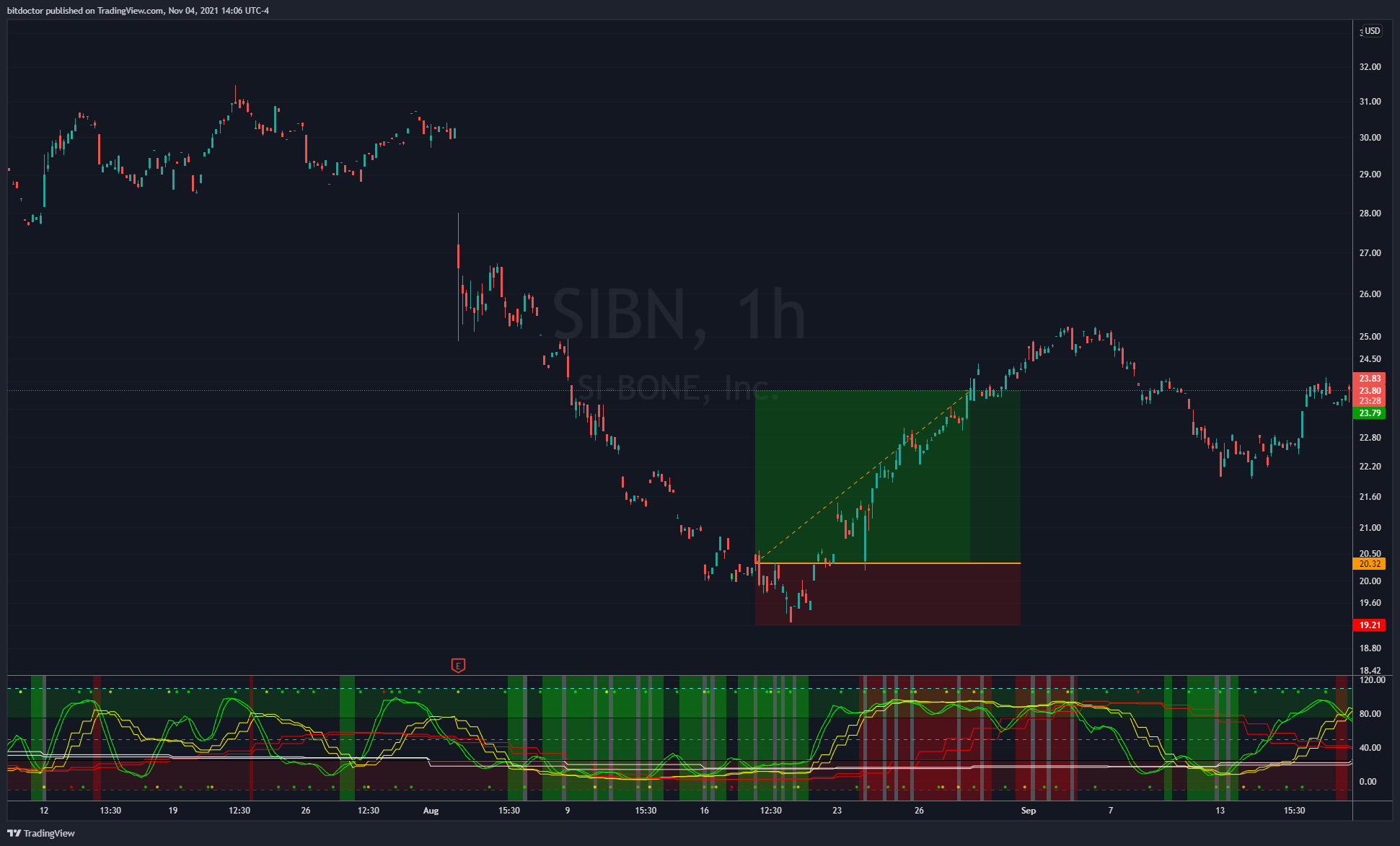 Immagine del grafico NASDAQ:SIBN di bitdoctor