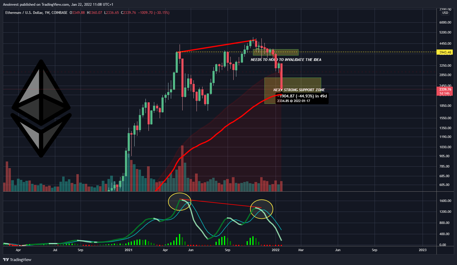 COINBASE:ETHUSD Chart Image by Anoinvest